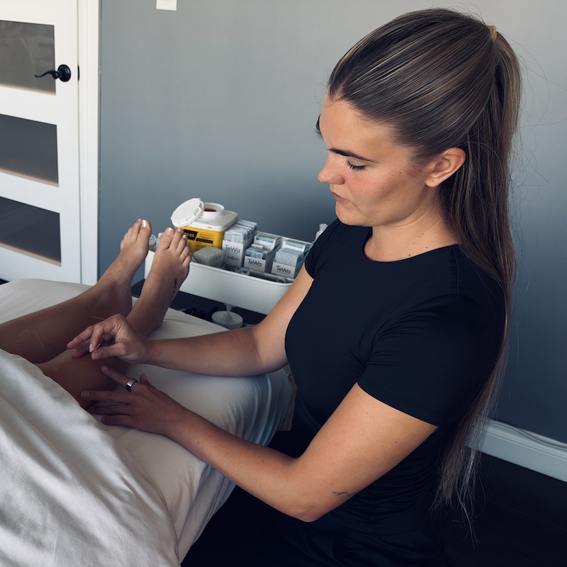Refined Health & Wellness | Acupuncture | Dr. Bentley Van Beek | Leg Acupuncture
