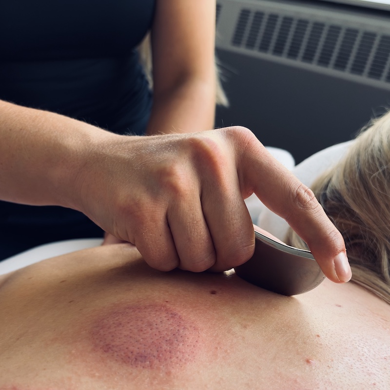 Refined Health & Wellness | Acupuncture | Dr. Bentley Van Beek | Gua Sha